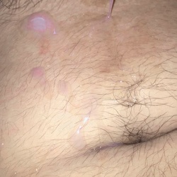 Mia - NPAPRVTB1